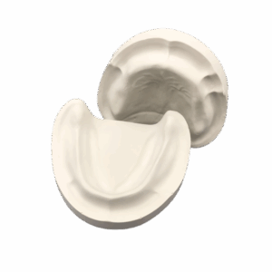 Juego de Modelos de Yeso Desdentados