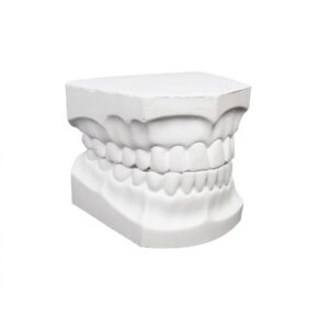 Juego de Modelos de Yeso Dentados – Superior e Inferior