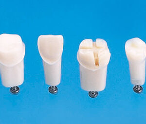 Muñón para Tipodonto NISSIN x Pieza